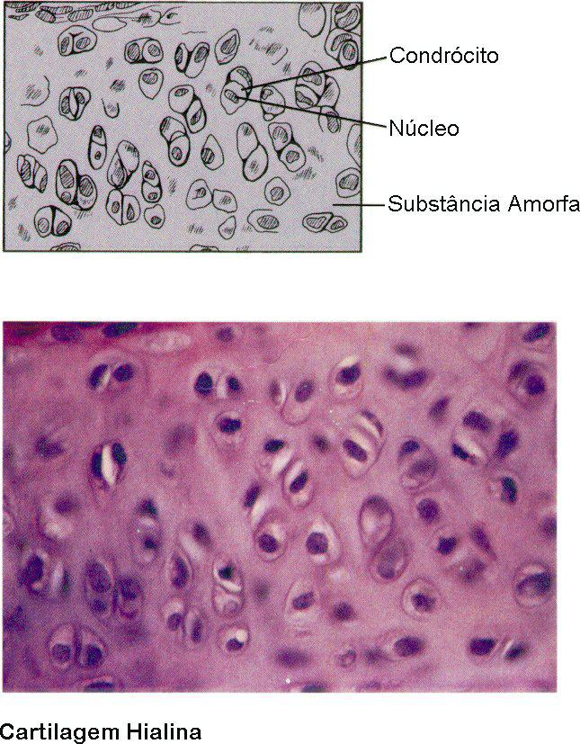 Cartilagem hialina Lâmina 07U Tipo mais comum de cartilagem Ocorre no final de osso de juntas, na parte mole do nariz e nos anéis de suporte de passagens