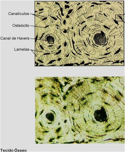 Tecido ósseo Osteócitos- células do tecido ósseo.