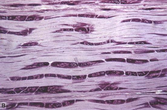 Fig. 5.44 Corte longitudinal de tecido conjuntivo denso modelado de tendão. A: Feixes espessos e paralelos de fibrilas de colágeno preenchem os espaços entre os fibroblastos.