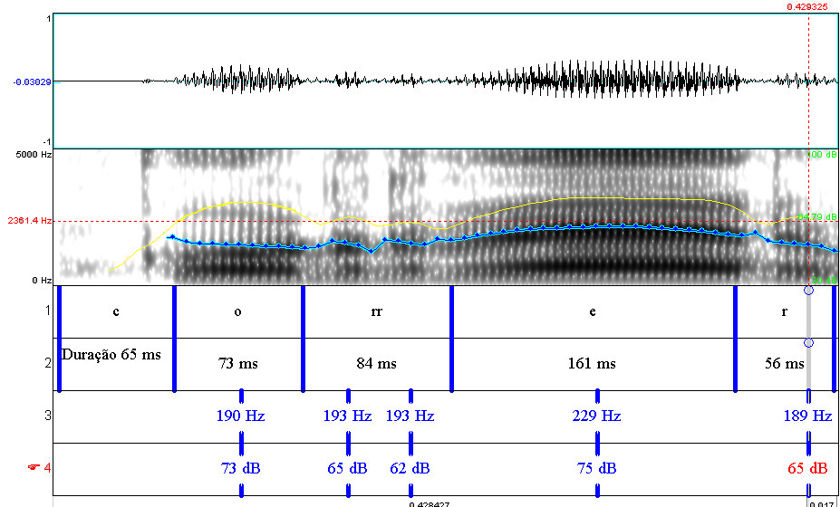 espectrogramas de banda larga, meio que permitiu a comparação das produções dos dois falantes. A unidade básica da análise acústica é a onda sonora.