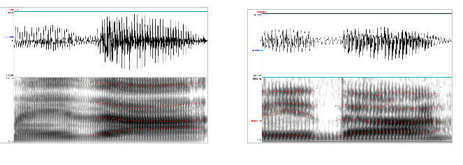 A inspeção espectrográfica dos dados permitiu contrastar as características fonético-acústicas das produções de consoantes em posição de coda silábica.