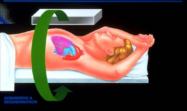 MEDICINA NUCLEAR SPECT Cardíaco - Posicionamento Posicionar bem centralizado com os braços o mais confortável;