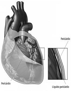 Bulha cardíaca (B4) Pequena intensidade Precede o restante da primeira bulha, pré sístole ventricular Ouvida em condições normais em crianças e jovens Patologica em adultos- galope Brusca