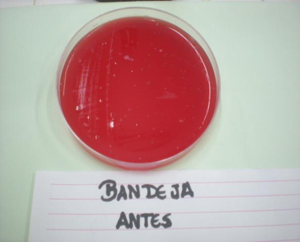 Tabela 1 Numero de microorganismos encontrados no meio de semeação ágar sangue antes de qualquer desinfecção prévia do encosto e bandeja Campina Grande, 2013.