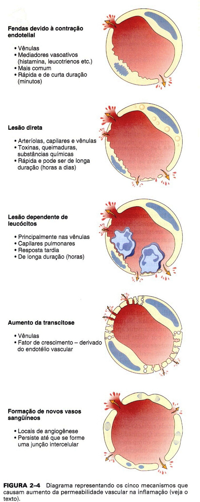 A perda de líquido resulta em uma concentração de hemácias nos vasos, aumento da viscosidade sanguínea e fluxo sanguíneo lento (estase), que facilita a adesão de leucócitos, especialmente os