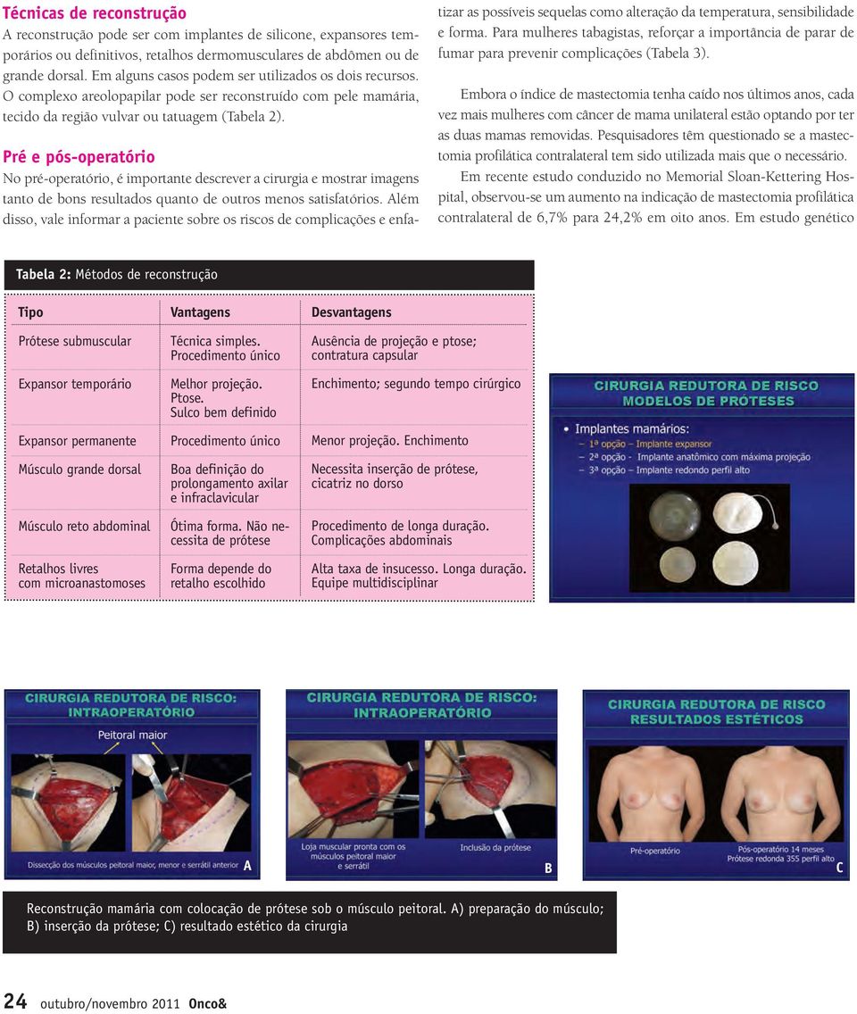 Pré e pós-operatório No pré-operatório, é importante descrever a cirurgia e mostrar imagens tanto de bons resultados quanto de outros menos satisfatórios.