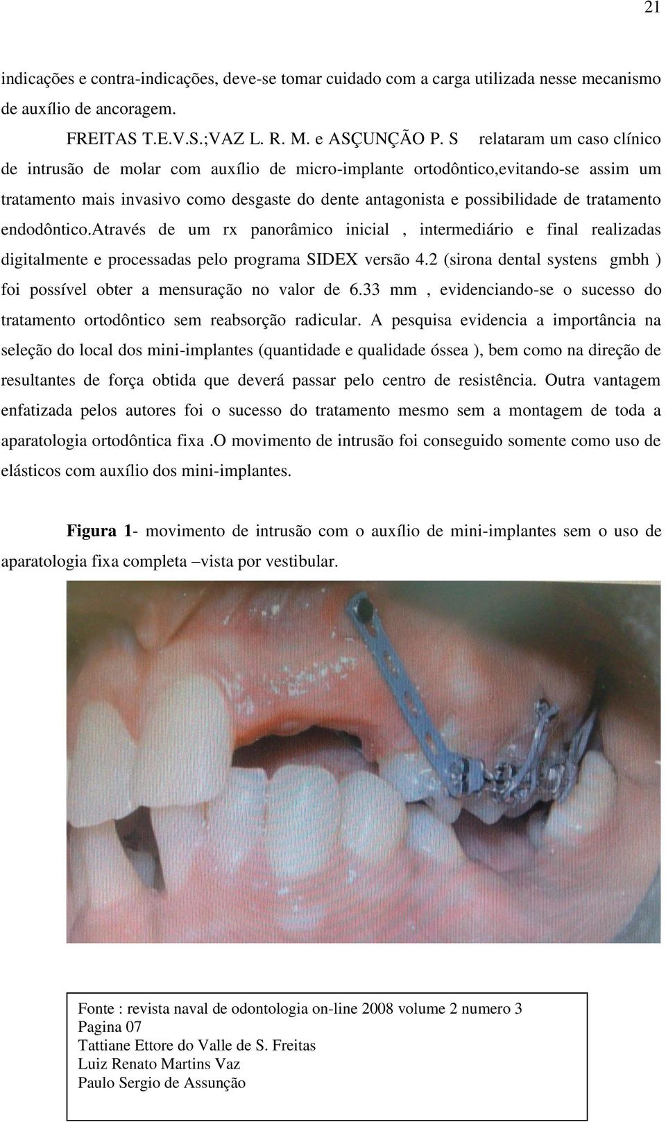 tratamento endodôntico.através de um rx panorâmico inicial, intermediário e final realizadas digitalmente e processadas pelo programa SIDEX versão 4.