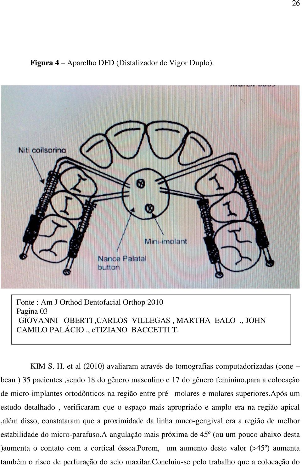 et al (2010) avaliaram através de tomografias computadorizadas (cone bean ) 35 pacientes,sendo 18 do gênero masculino e 17 do gênero feminino,para a colocação de micro-implantes ortodônticos na