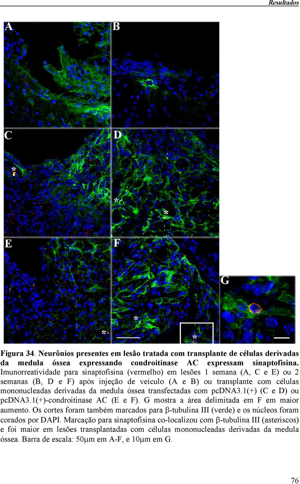 óssea transfectadas com pcdna3.1(+) (C e D) ou pcdna3.1(+)-condroitinase AC (E e F). G mostra a área delimitada em F em maior aumento.