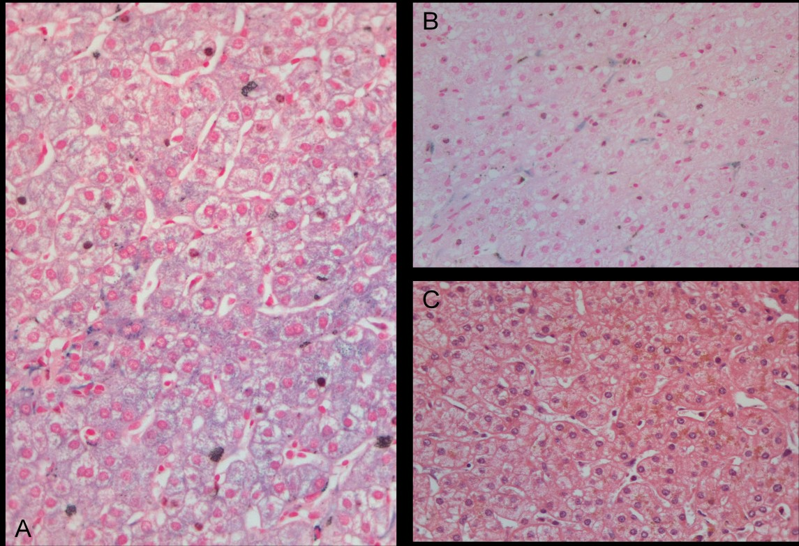 37 Figura. Avaliação de deposição de pigmentos férrico e lipofuscínico. A Siderose leve hepatocitária e em células de Kupffer (mista) (Hematoxilina e eosina x).