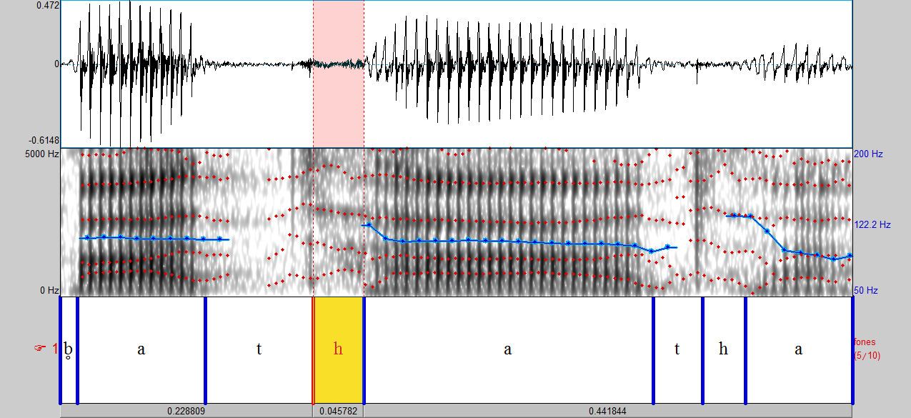 Fig. 3 Oscilograma e espectrograma representando a pronúncia da palavra batata por informante alemão de nível básico no aprendizado do PB.