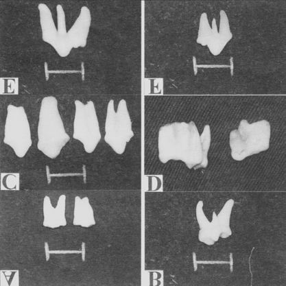 Variações anatômicas na dentição de cães sem raça definida.