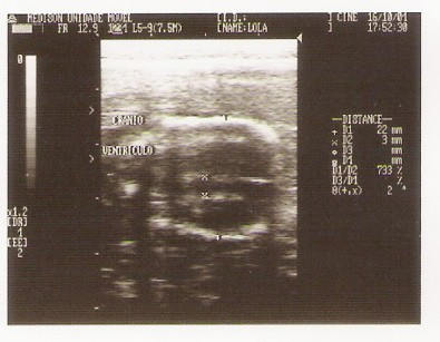 20 4.1.2.1.Diâmetro biparietal Pode ser observado de 27 a 33 dias até o final da gestação (Tabela 2). 4.1.2.2. Comprimento fetal 3).