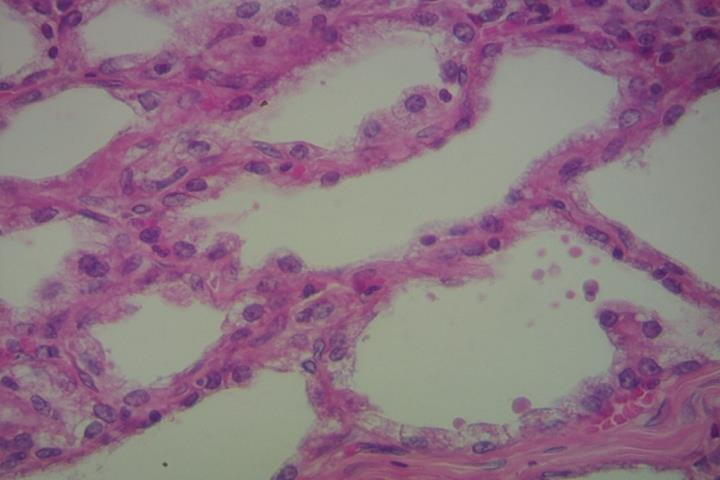 Lâmina 108A: Glândula mamária em lactação Células
