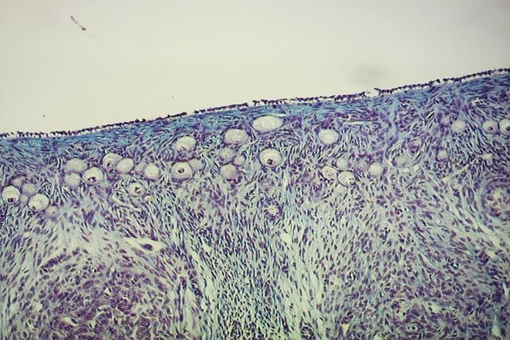 Lâmina 72A: Superfície do ovário Epitélio germinativo (Epitélio