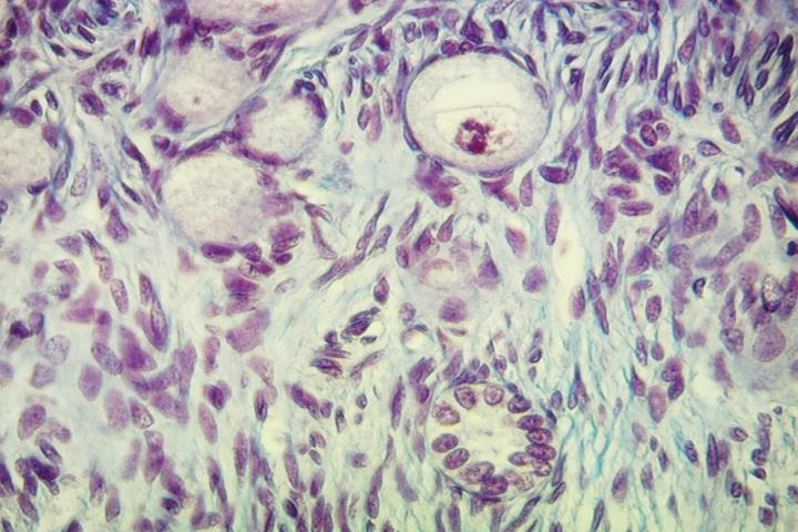 Lâmina 72A: Córtex do ovário Folículo primordial Ovócito Células foliculares pavimentosas