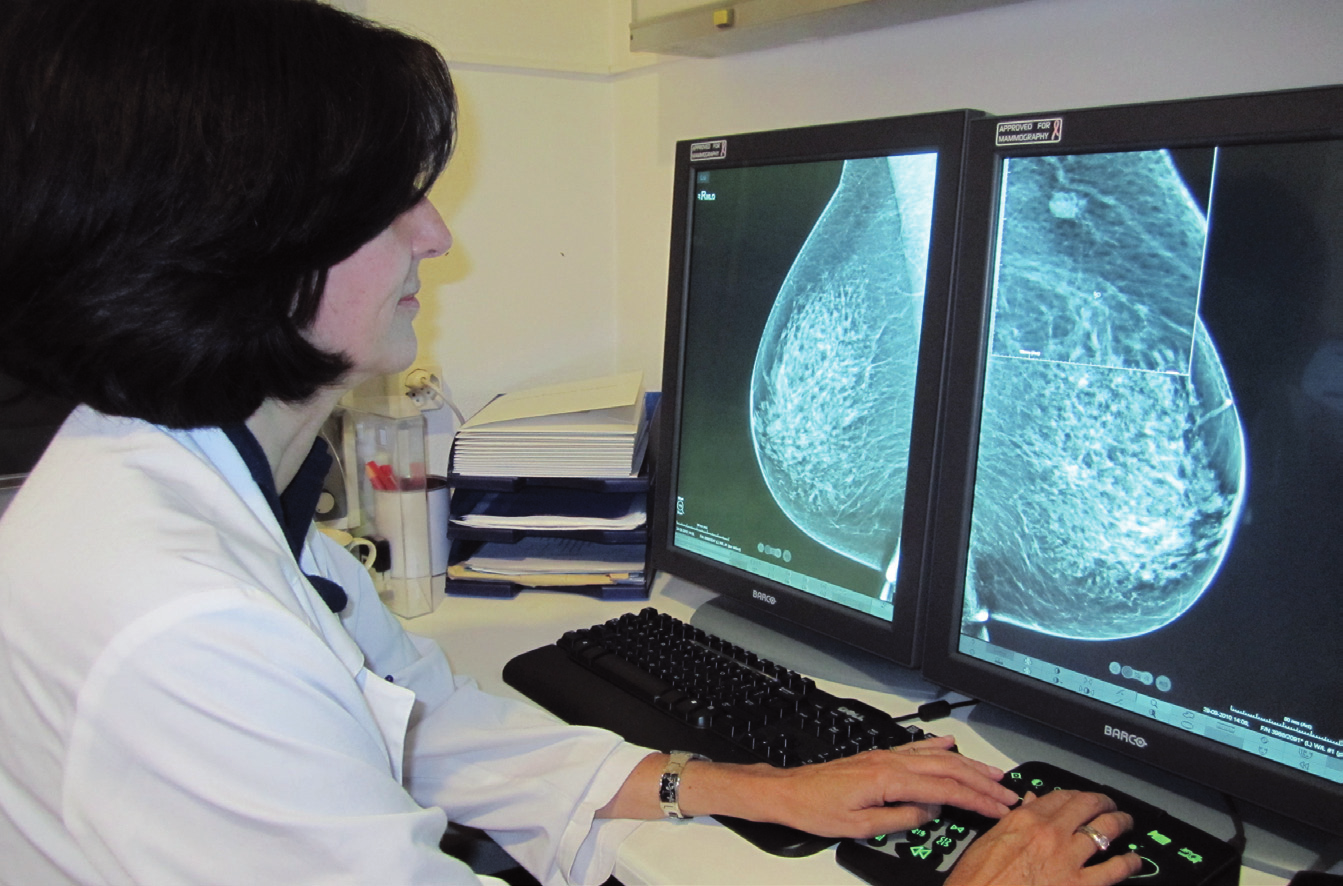 Quais são as vantagens e benefícios, as desvantagens e riscos da mamografia no âmbito de um programa de despistagem?