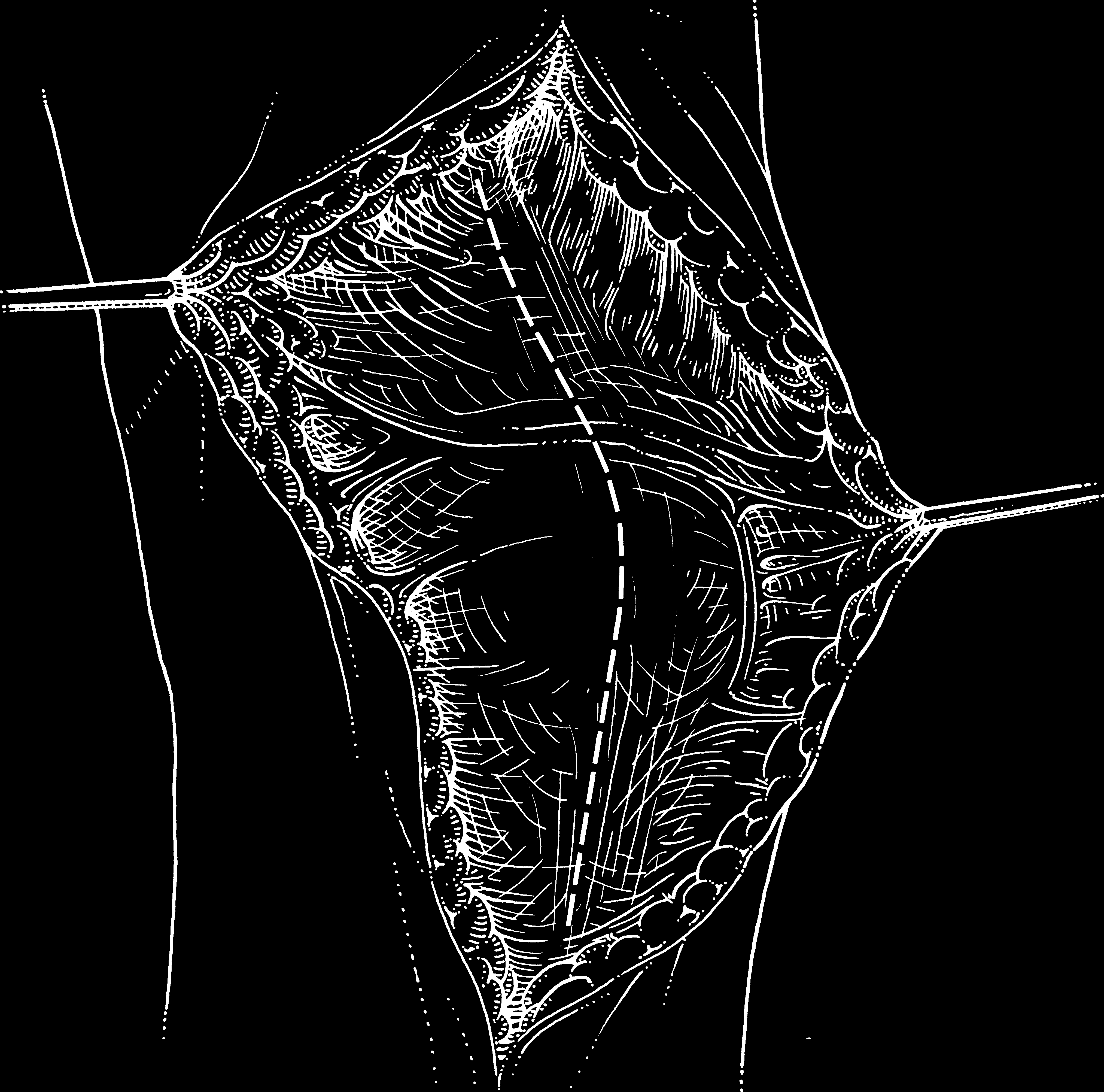 > Vias de acesso ao membro inferior 1663 reto femoral vasto sartório Banda iliotibial vasto medial Côndilo femoral Patela Bursa suprapatelar Côndilo femoral medial Cabeça da fíbula fibular longo