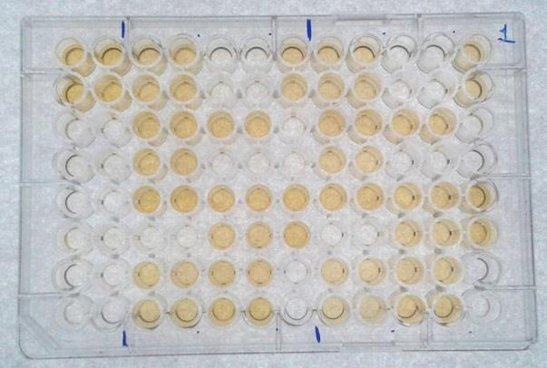 28 duplicata. Neste caso, porém, cada poço testado recebeu incubação adicional de 10 minutos a 37ºC com 100 µl solução caotrópica neutra de uréia 6M contendo PBS- Tween 20 0,02M ph 7,2.