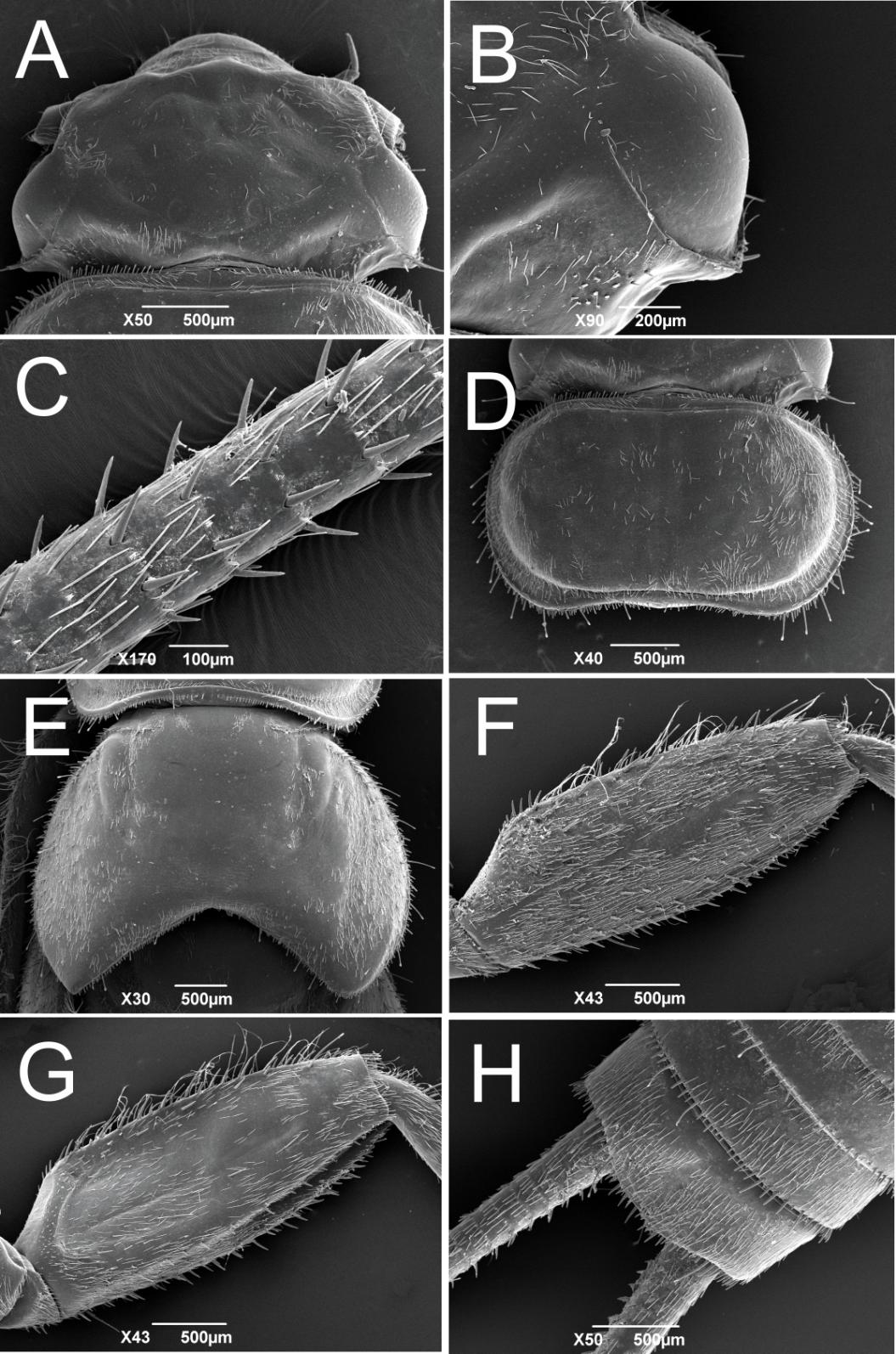 Figura 33. Anacroneuria boraceiensis Froehlich. Ninfa: A. Cabeça. B. Cabeça, detalhe das cerdas do esclerito ocular; B. Antena; C.