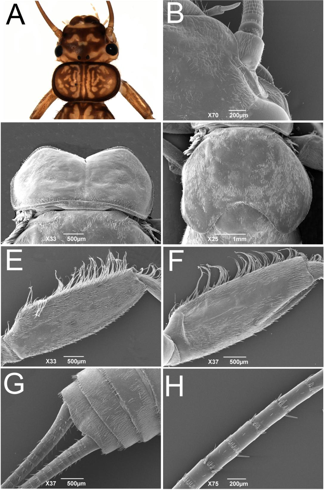 Figura 39. Anacroneuria ipiau sp. nov. Ninfa: A. Cabeça, detalhe das cerdas do esclerito ocular; B. Antena, escapo; C.