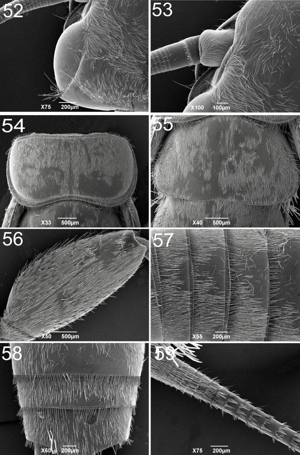 Figura 60. Kempnyia reticulata (Klapálek). Ninfa: A. Cabeça, detalhe das cerdas do esclerito ocular; B. Base da antena base, em vista dorsal; C.