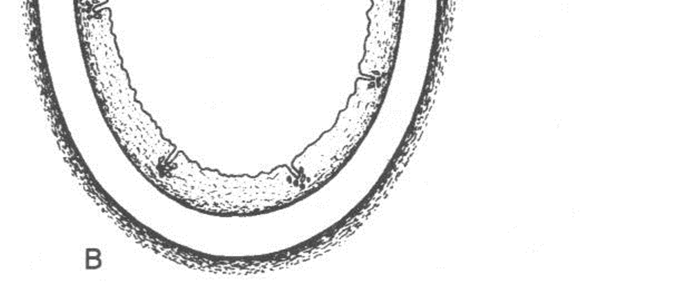 6- TRAQUÉIA parede: - mucosa - anel cartilaginoso (anel da traquéia) - ligamento