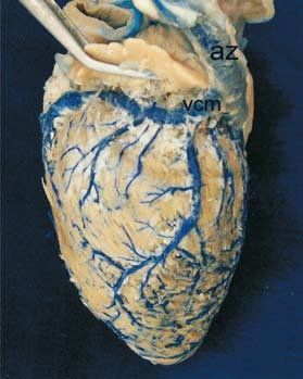 Figura 5 Coração de ovino, visto pela face esquerda, cujos vasos receberam injeção de látex corado em azul através do seio coronário, posteriormente fixado com formol a 10% e dissecado.