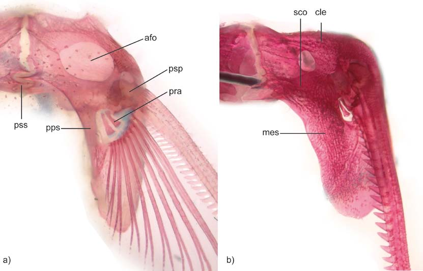 Figure 17. Dorsal fin in lateral view. a) Corydoras nattereri (MCP 14980, 46.8 mm SL), b) Callichthys callichthys (MCP 7026, 54.1 mm SL).