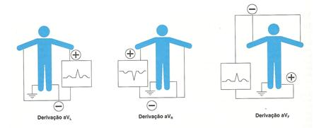 Nas derivações unipolares, o polo negativo sempre no eletrocardiógrafo e também a perna direita serve de polo terra.