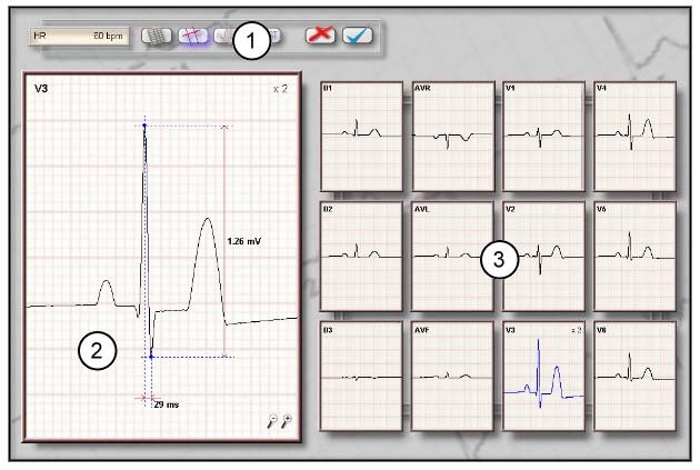 5. TELA DE MEDIÇÕES MANUAIS Esta tela permite realizar medições não consideradas na tela de medições automática.