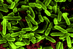Bactéria gram-positiva Bactéria