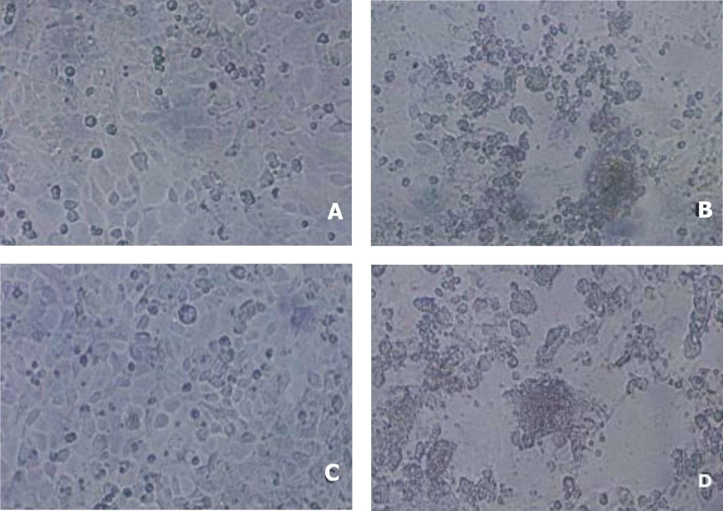 Ausência de efeito citopático em células tratadas com sirna/n Fig. 1. CPE in transfected cells after 3 days (200 ). CER cells were transfected with sirnas at 75 nm.