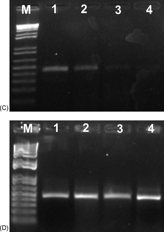 Impacto na produção de RNAm G Effect of different sirnas on GmRNAproduction (448 bp) in the culture supernatants from infected cells, as indicated: