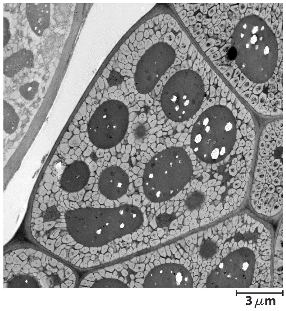 Nas células são acumulados em vesículas - células animais (adipócitos) e vegetais (principalmente em sementes) possuem no citoplasma gotículas de triglicerídeos.