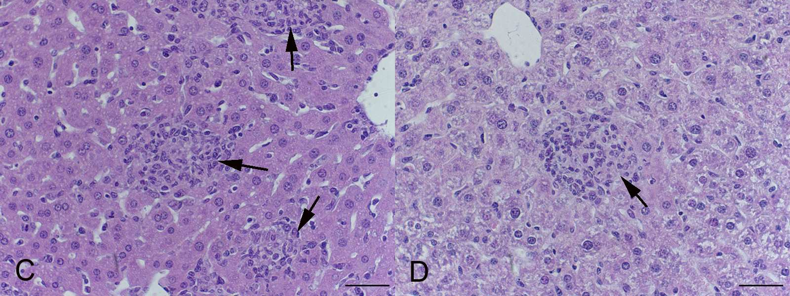Figura 6: Histopatologia e imunomarcação de fígado de animais knockout MyD88 após 7 dpi com Brucella ovis. (A) Fígado de animal MyD88-/- após sete dias de infecção por B.