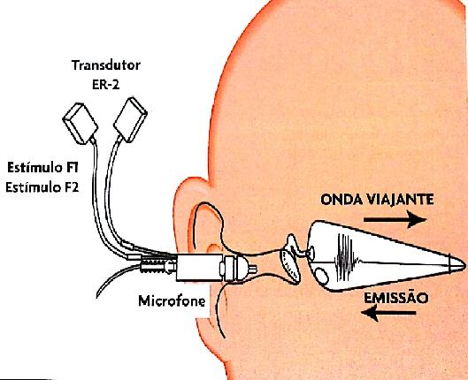 21 Devido à capacidade das EOA revelarem a situação do funcionamento das CCEs, tal exame vem sendo aplicado como procedimento de avaliação auditiva em diversas situações clínicas (14), como por