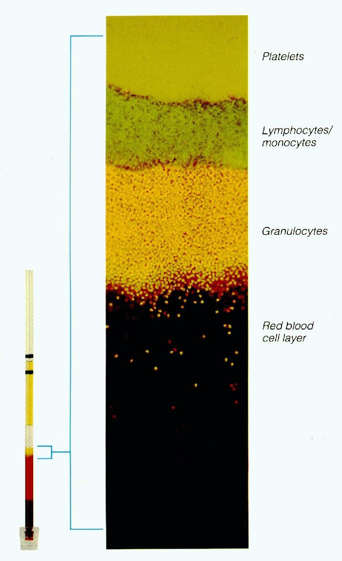 QBC (Quantitative Buffy Coat) ou Teste do capilar Combina a concentração dos parasitas pela centrifugação do sangue nos capilares e a coloração dos ácidos nucléicos (DNA e RNA) do parasita