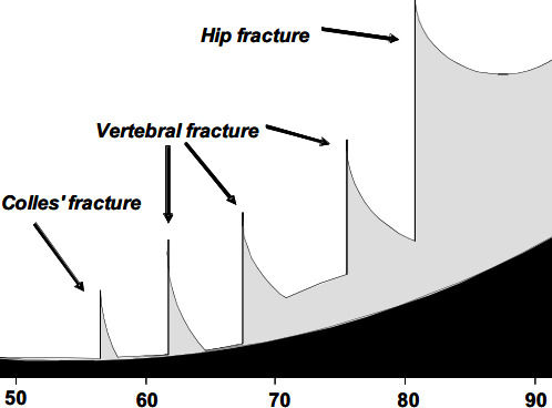 Prevenção 1ª, 2ª e 3ª 50-66% das fracturas do fémur proximal tiveram fractura osteoporótica prévia < 1/3 são