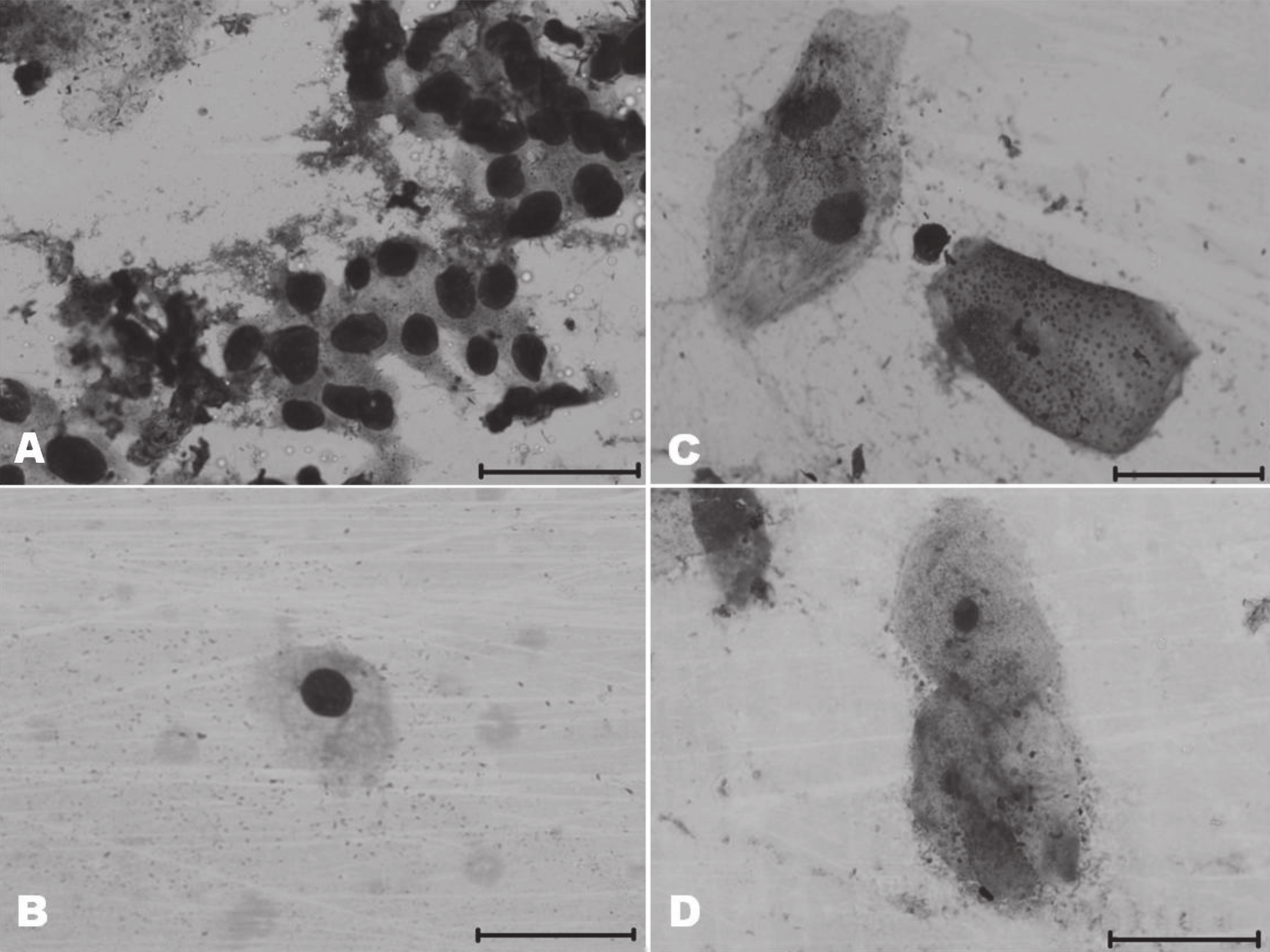 274 Paola Pereira das Neves Snoeck et al. Fig.2. Citologia vaginal de preguiça-de-coleira. (A) Presença de células parabasais. (B) Célula intermediária pequena.