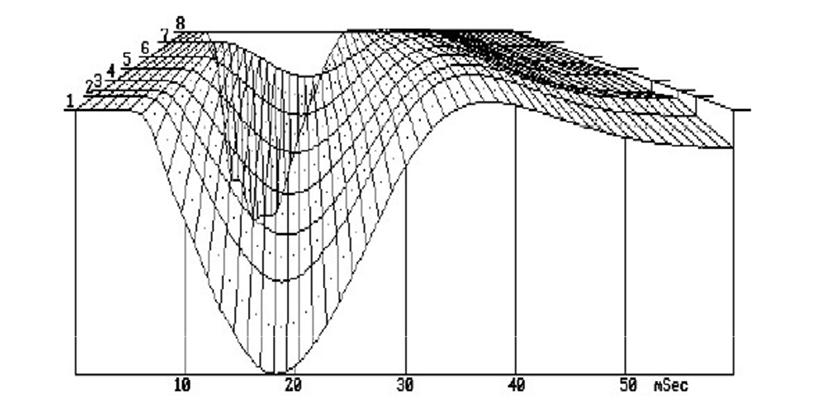 11 Figura 4 - Exemplo ilustrativo de uma bacia de deflexão A Figura 5 apresenta os resultados da retroanálise para uma estrutura de pavimento semelhante à indicada na Figura 2.