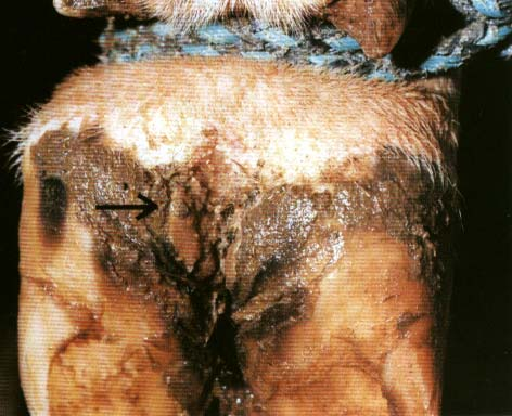 Figura 1. Dermatite interdigital, causada por Dichelobacter nodosus em provável sinergismo com Fusobacterium necrophorum e Spirochaetas. (Fonte: GARCIA e BORGES 2000).