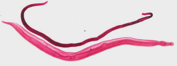 Fotomicroscopia. Vermes adultos de Schistosoma mansoni. A seta indica o macho, e cabeça de seta a fêmea.