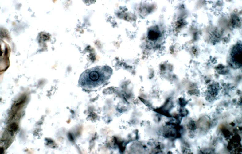 Fotomicroscopia. Material fecal humano contendo trofozoíto de Entamoeba histolytica.