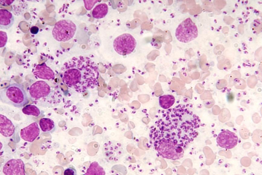 Esfregaço de fígado contendo formas amastigotas de Leishmania