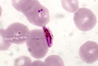 Plasmodium falciparum.