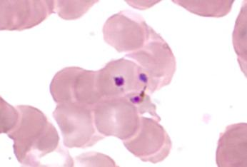 Plasmodium vivax.