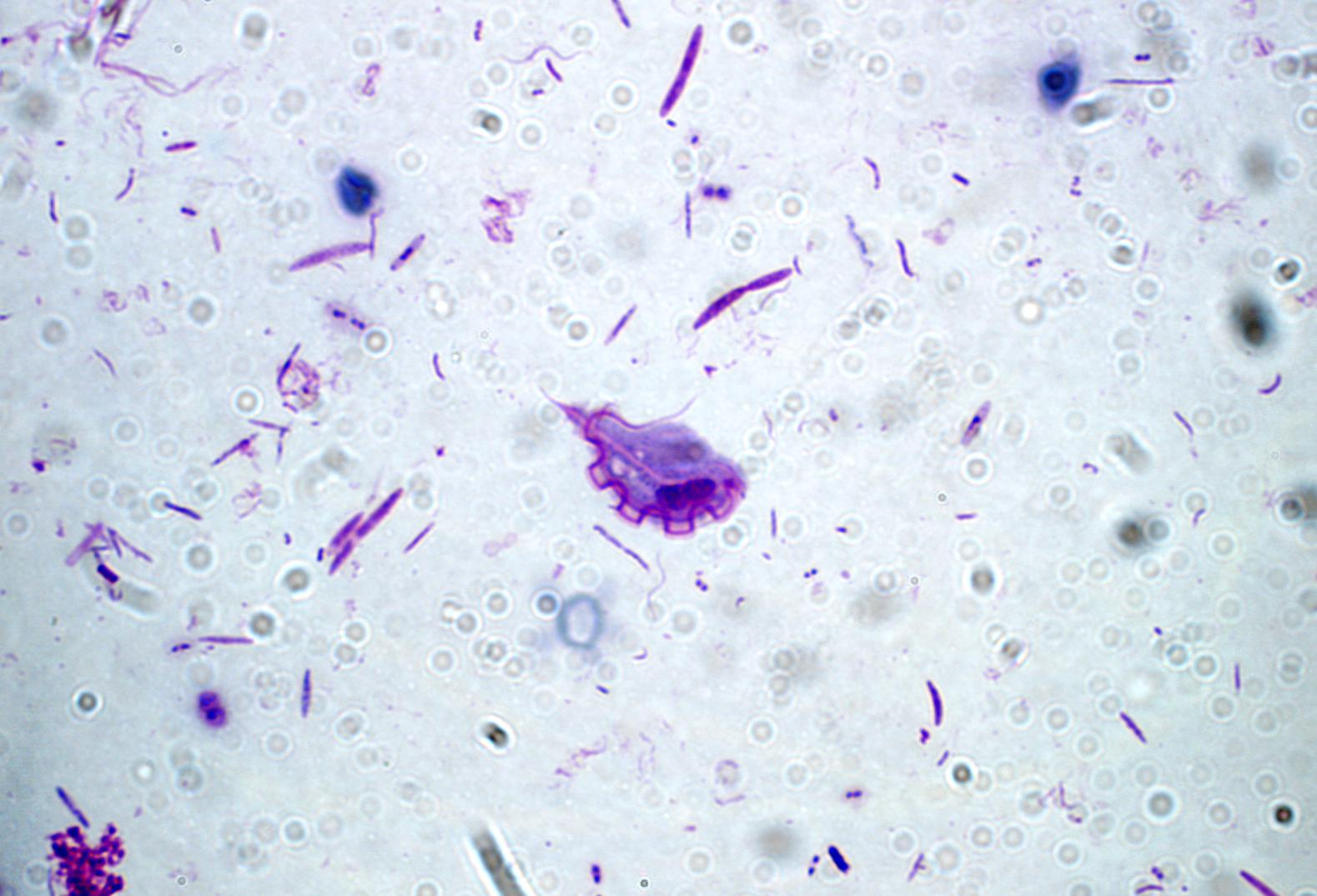 Fotomicroscopia. Trofozoíto de Trichomonas hominis. A forma trofozoíta está indicada pela seta (x100).