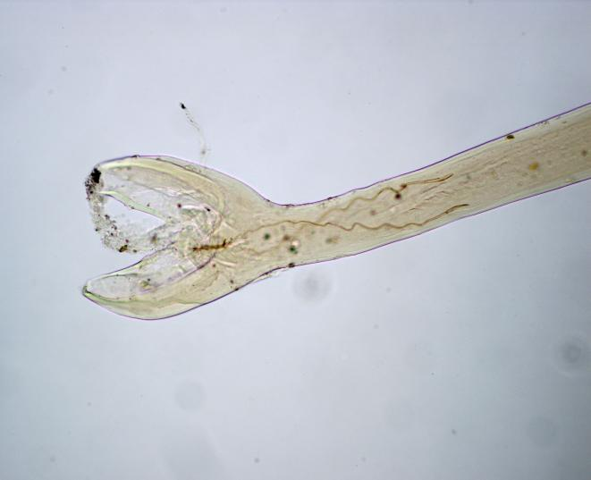 Ovo de Ancylostomidae tem formato oval e mede cerca de