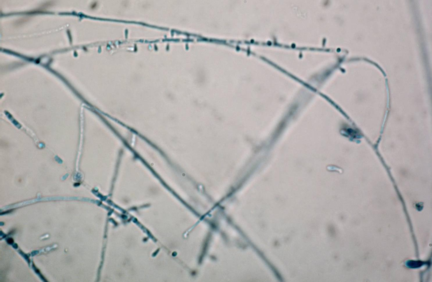 Aspecto microscópico: Fungo filamentoso hialino, septado e Microconídios